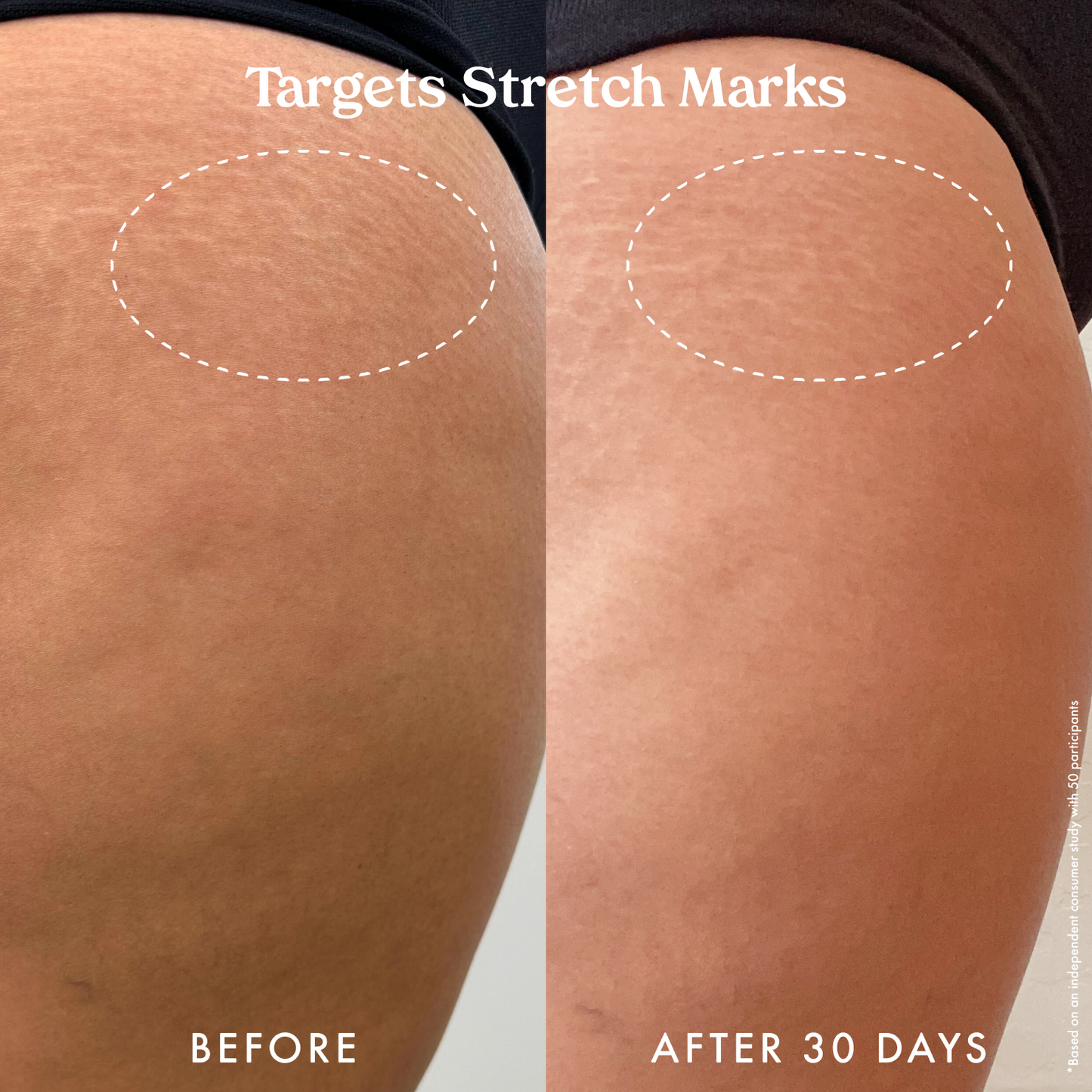Ultra Renewal Retinol Body Cream