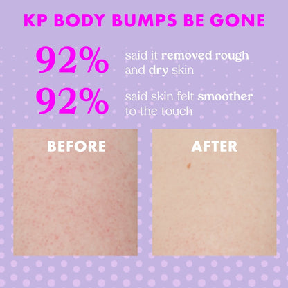KP Body Bumps Be Gone Scrub