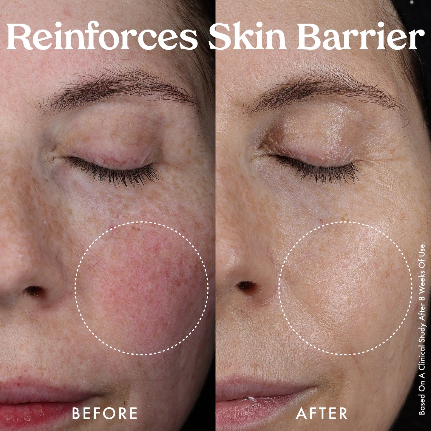 Nourishing Hydro-Lipid Barrier Serum